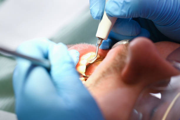 Best Emergency Treatment for Dental Infections or Abscesses in Elwood, KS