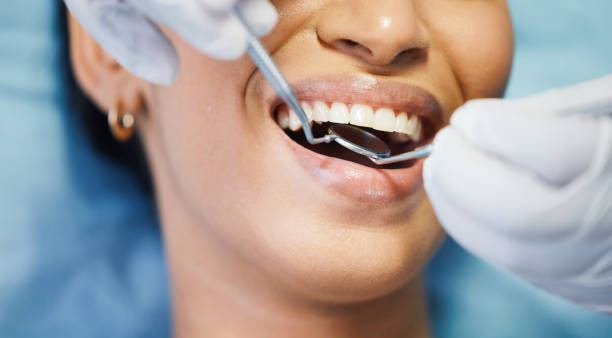 Best Emergency Tooth Extraction in Elwood, KS